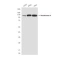 Western blot detection of Hexokinase-2 (N-terminus) antibody in PC12, Hela&Jurkat lysates using Hexokinase-2 (N-terminus) antibody (1:1000 diluted) .