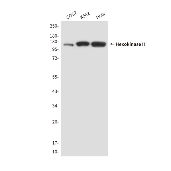 Western blot detection of Hexokinase-2 (N-terminus) antibody in PC12, Hela&Jurkat lysates using Hexokinase-2 (N-terminus) antibody (1:1000 diluted) .