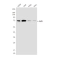 Western blot detection of NFE2L1 in Hela, K562, CEM&U2OS cell lysates using NFE2L1 antibody (1:1000 diluted) .