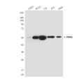 Primary: Anti-PKM2 at 1/1000 dilution