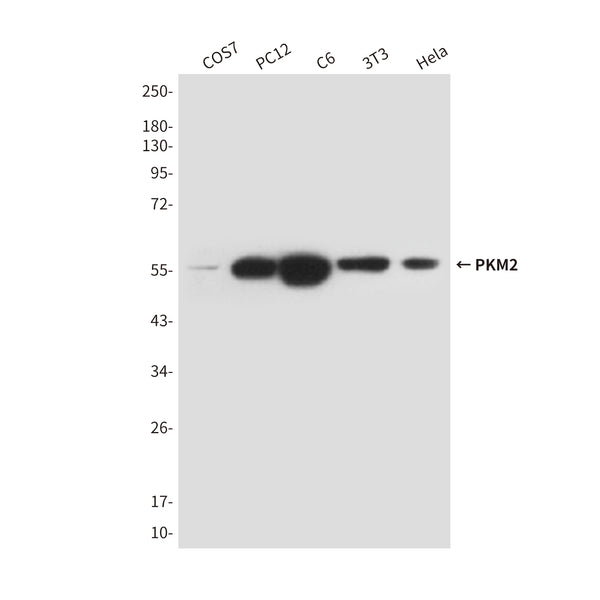Primary: Anti-PKM2 at 1/1000 dilution