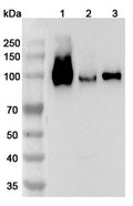 Western blot analysis was performed using anti-VCAM1 polyclonal antibody at 1ug/mL on various samples.
Lane 1: Mouse spleen lysate
Lane 2: Mouse brain lysate
Lane 3: Mouse lung lysate