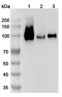 Western blot analysis was performed using anti-VCAM1 polyclonal antibody at 1ug/mL on various samples.
Lane 1: Mouse spleen lysate
Lane 2: Mouse brain lysate
Lane 3: Mouse lung lysate