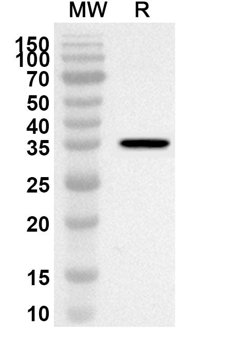 Western blot analysis was performed using anti-Mouse IGFBP4 polyclonal antibody at 1ug/mL on recombinant Mouse IGFBP4 (Catalog No. MB140012).