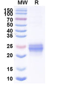Recombinant Mouse EFNA1 Protein, C-His