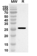 Western blot analysis was performed using anti-Mouse MST1 polyclonal antibody at 1ug/mL on recombinant Mouse MST1 (Catalog No. MB203012).