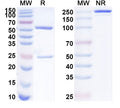SDS-PAGE for Anti-Phospho-AKT1 (pS473) Antibody (P8.H9).