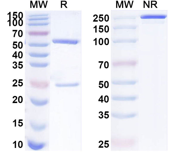 SDS-PAGE for Anti-Phospho-AKT1 (pS473) Antibody (P8.H9).