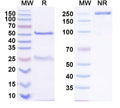 SDS-PAGE for Anti-Phospho-AKT1 (pS212) Antibody (SAA0279)