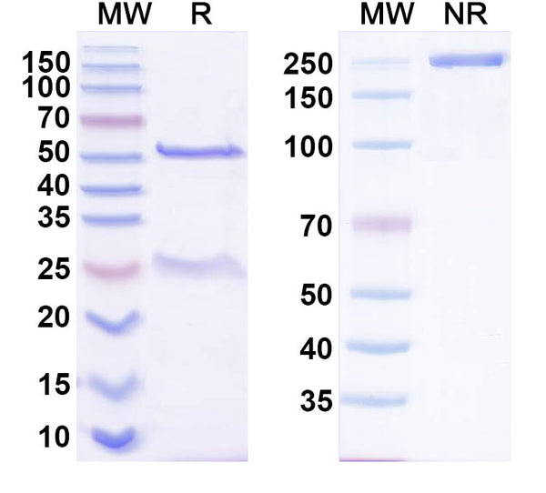 SDS-PAGE for Anti-Phospho-AKT1 (pS212) Antibody (SAA0279)