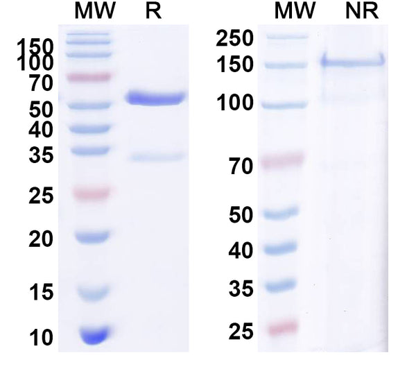 SDS-PAGE for Anti-Mouse CD35/CR1/CD21b Antibody (8C12)