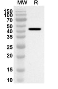 Western blot analysis was performed using anti-Mouse GUCY2C/GCC polyclonal antibody at 1ug/mL on recombinant Mouse GUCY2C/GCC (Catalog No. MB626012).