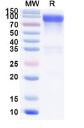 Recombinant Mouse CD333/FGFR3 Protein, C-Fc
