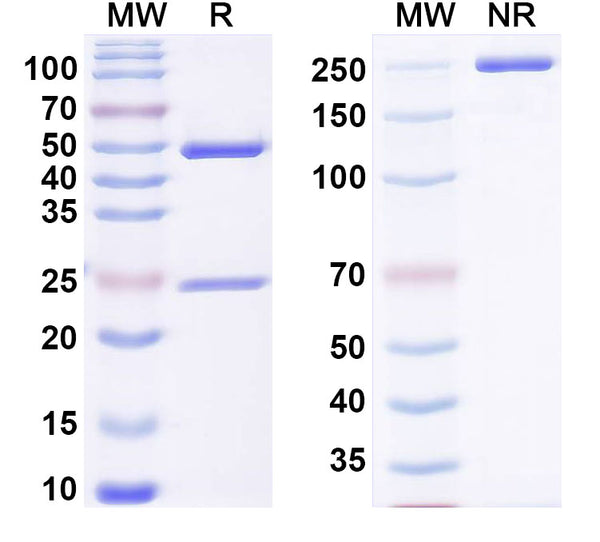 SDS-PAGE for Anti-Mouse PLCG1 Antibody (SAA0275)
