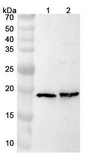 Anti-Mouse ADCYAP1 Polyclonal Antibody – Lane 1: Hela cell lysateLane 2: 293T cell lysate