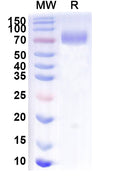 Recombinant Mouse CD6 Protein, C-Fc