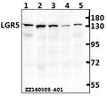 Western blot (WB) analysis of LGR5 mAb at 1:500 dilution
Lane1:Hct116 whole cell lysate(40ug)
Lane2:SGC7901 whole cell lysate(40ug)
Lane3:Hela whole cell lysate(40ug)
Lane4:PC12 whole cell lysate(40ug)
Lane5:CT-26 whole cell lysate(40ug)