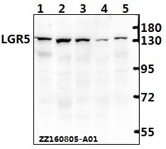 Western blot (WB) analysis of LGR5 mAb at 1:500 dilution
Lane1:Hct116 whole cell lysate(40ug)
Lane2:SGC7901 whole cell lysate(40ug)
Lane3:Hela whole cell lysate(40ug)
Lane4:PC12 whole cell lysate(40ug)
Lane5:CT-26 whole cell lysate(40ug)