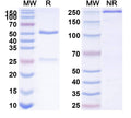 SDS-PAGE for Anti-Mouse CD11a/ITGAL Antibody (M17/4)