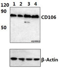Western blot (WB) analysis of CD106/VCAM1 (2C11) mAb at 1:500 dilution
Lane1:Hela whole cell lysate(40ug)
Lane2:Hela treated with TNF-α (20ng/ml, 30min) whole cell lysate (40ug)
Lane3:Hela treated with TNF-α (20ng/ml, 15min) whole cell lysate (40ug)
Lane4:HepG2 whole cell lysate(40ug)