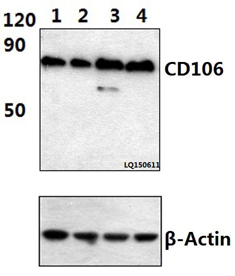 Western blot (WB) analysis of CD106/VCAM1 (2C11) mAb at 1:500 dilution
Lane1:Hela whole cell lysate(40ug)
Lane2:Hela treated with TNF-α (20ng/ml, 30min) whole cell lysate (40ug)
Lane3:Hela treated with TNF-α (20ng/ml, 15min) whole cell lysate (40ug)
Lane4:HepG2 whole cell lysate(40ug)