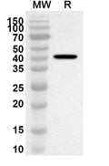 Western blot analysis was performed using anti-Mouse SDC4 polyclonal antibody at 1ug/mL on recombinant Mouse SDC4 (Catalog No. MB860022).