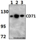 Western blot (WB) analysis of CD71 monoclonal antibody at 1:500 dilution
Lane1:RAW264.7 whole cell lysate(40ug)
Lane2:PC12…