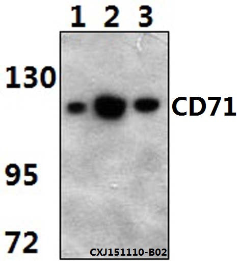 Western blot (WB) analysis of CD71 monoclonal antibody at 1:500 dilution
Lane1:RAW264.7 whole cell lysate(40ug)
Lane2:PC12…