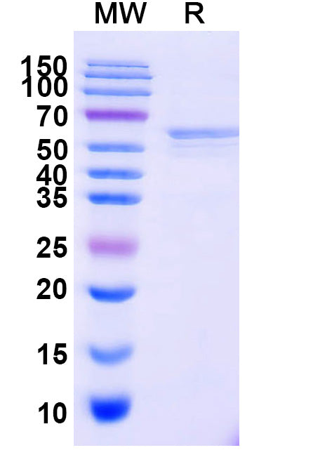 Recombinant Mouse CD332/FGFR2 Protein, C-His