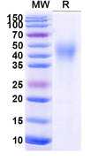 Recombinant Mouse CD332/FGFR2 Protein, C-His