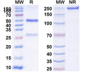 SDS-PAGE for Anti-Mouse CD62E/SELE Antibody (SAA0513)