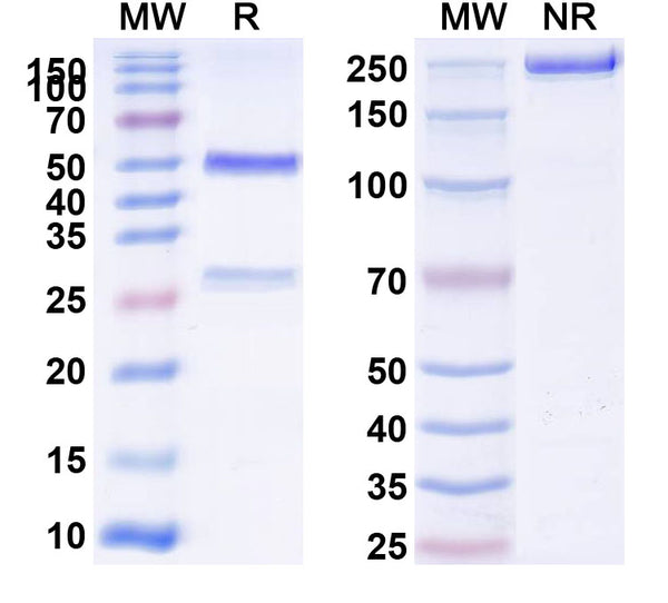 SDS-PAGE for Anti-Mouse CD62E/SELE Antibody (SAA0513)