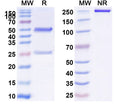 SDS-PAGE for Anti-Mouse CD140a/PDGFRA Antibody (2.451.1.1b#)