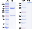Flow-cytometry using anti-mouse MMP9 antibody.MMP9 Transfected CHO cells were stained with an irrelevant antibody (Blue Histogram) or an anti-mouse MMP9 antibody monoclonal antibody (Catalog # MB945023 ,Green Histogram) at a concentration of 5 µg/ml for 30 mins at RT. After washing, bound antibody was detected using a FITC conjugated goat anti-mouse antibody (Catalog # MF690414) and cells analysed on a NovoCyte Flow Cytometer.