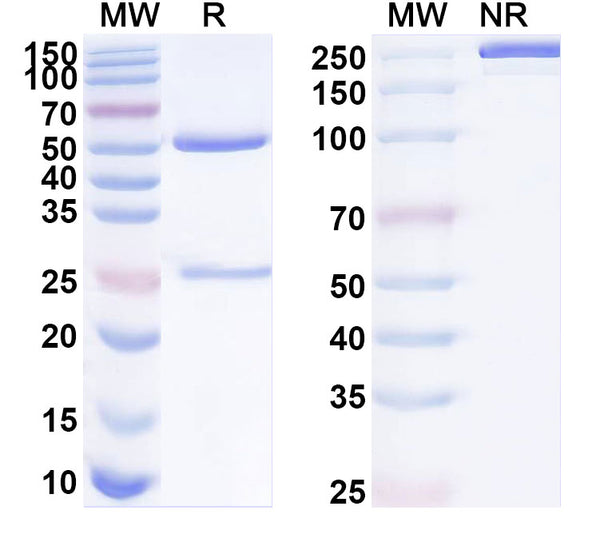 Flow-cytometry using anti-mouse MMP9 antibody.MMP9 Transfected CHO cells were stained with an irrelevant antibody (Blue Histogram) or an anti-mouse MMP9 antibody monoclonal antibody (Catalog # MB945023 ,Green Histogram) at a concentration of 5 µg/ml for 30 mins at RT. After washing, bound antibody was detected using a FITC conjugated goat anti-mouse antibody (Catalog # MF690414) and cells analysed on a NovoCyte Flow Cytometer.