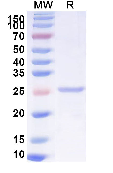 Recombinant Mouse LAMA2 Protein, N-His