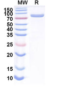 Recombinant Mouse TF/Serotransferrin Protein, C-His