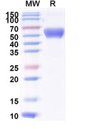 Recombinant Mouse CD69 Protein, C-Fc