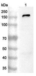 Western blot analysis was performed using anti-PTK7 polyclonal antibody at 1ug/mL on various samples.
Lane 1: A431 cell lysate
