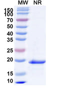 Recombinant Mouse IL24 Protein, N-His