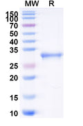 Recombinant Mouse CD91/LRP1 Protein, N-His