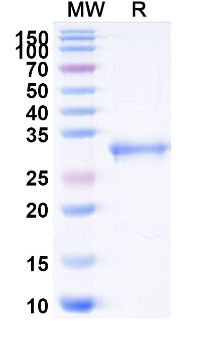 Recombinant Mouse CD91/LRP1 Protein, N-His