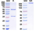 SDS-PAGE for Anti-Mouse NOTCH2/3 Antibody (59R1)