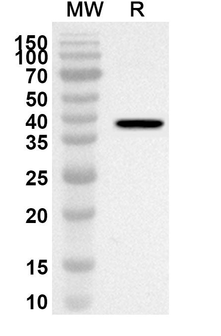 Western blot analysis was performed using anti-Mouse GIT2 polyclonal antibody at 1ug/mL on recombinant Mouse GIT2 (Catalog No. MC671012).