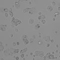 MDA-MB-175-VII cell