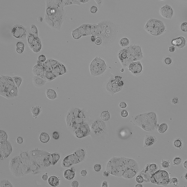 MDA-MB-175-VII cell
