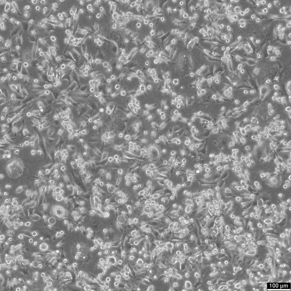 MDA-MB-231 cell