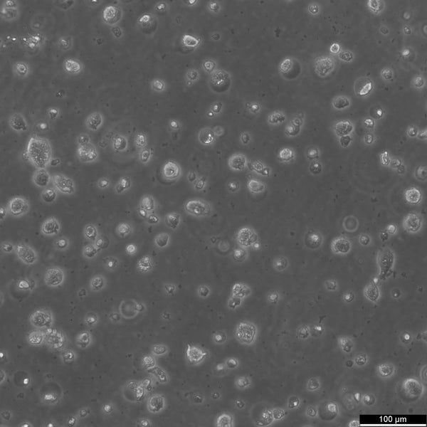 MDA-MB-231-GFP cell