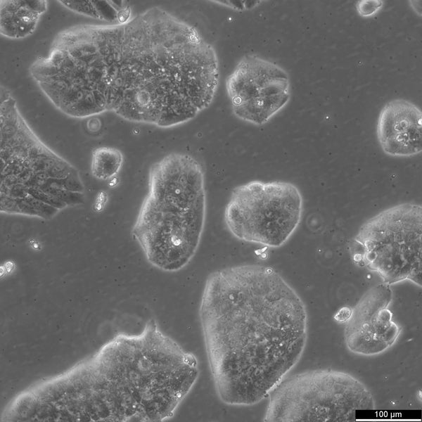 MDA-MB-361 cell