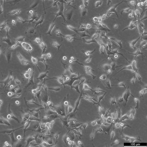 MDA-MB-436 cell